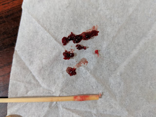 圖片顯示沾著血的碎棉花屑，與殘餘木棒的部分